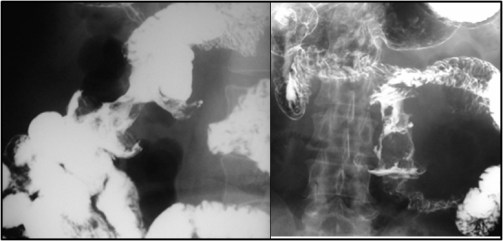 corazón de manzana3