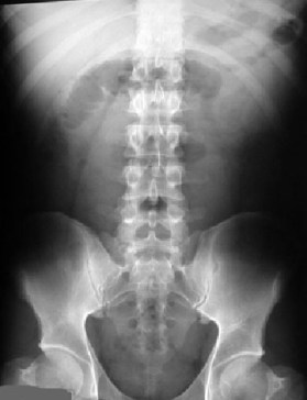 asa centinela2 copiar