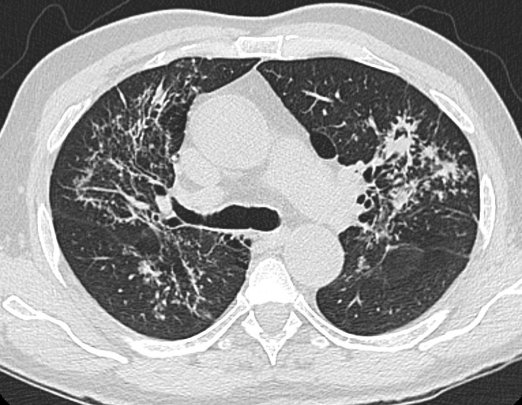 La imagen tiene un atributo ALT vacío; su nombre de archivo es galaxia.jpg